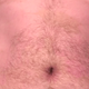 Illustration for article titled Dr. Pimple Popper Removes 68 Lipomas from One Person in Season 2 Premiere